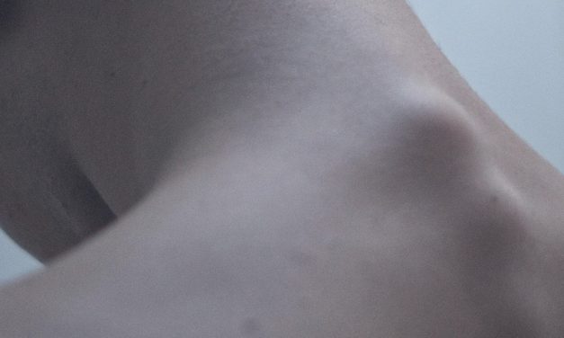 Torcicolo: como se produz e como evitar