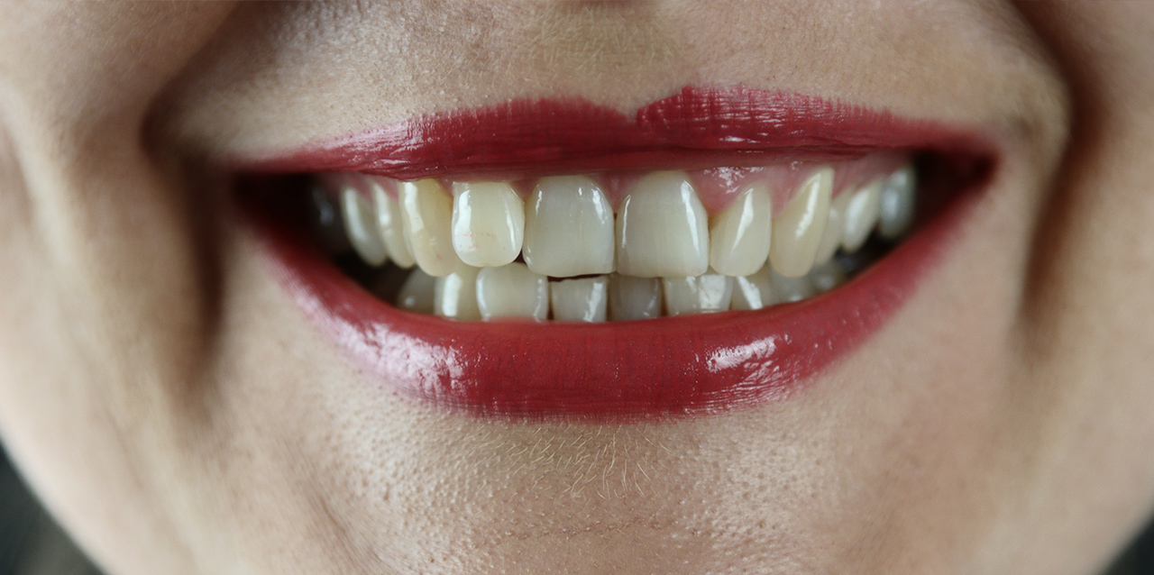 sorrir dentes